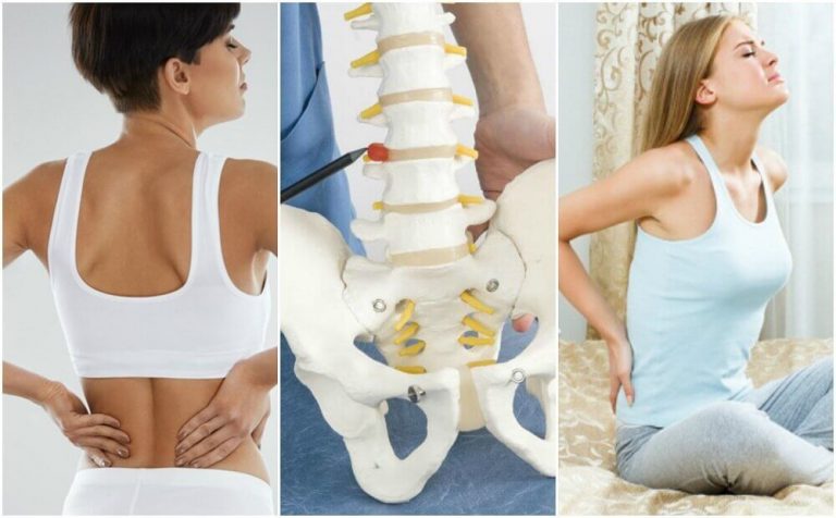 8 medicinske årsager til rygsmerter