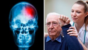 Hvad er et mini slagtilfælde? Nøglen til at opdage det