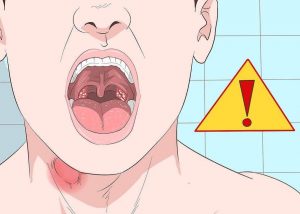 5 mulige tegn på stemmebåndsknuder