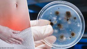 Hvorfor opstår vaginale infektioner?