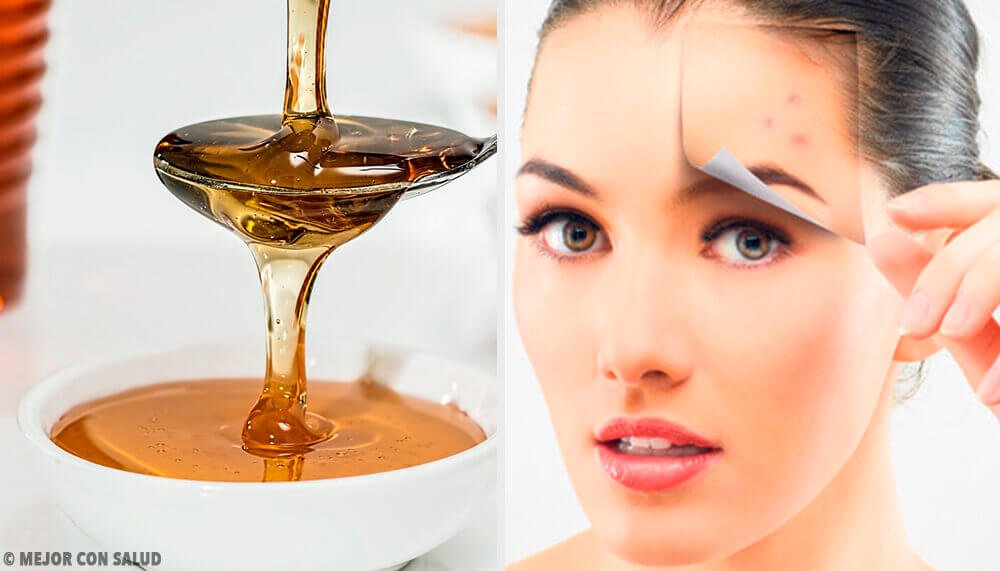 4 naturlige opskrifter til at beskytte din hud