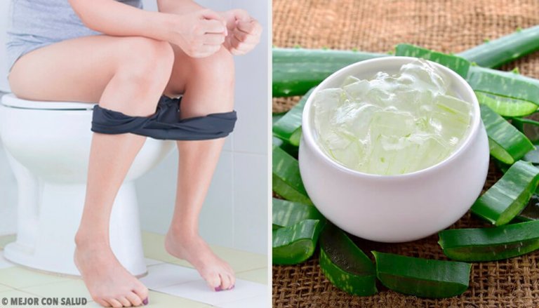 Behandling af hæmorider