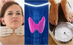 10 tegn på, at du har hypothyroidisme