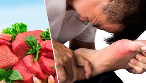 7 fødevarer, der øger urinsyre niveauerne