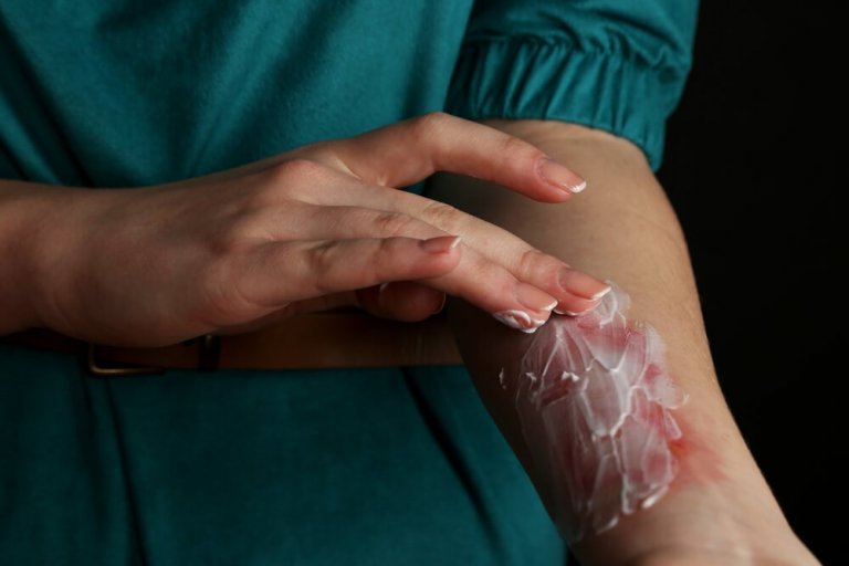 Creme paa forbraending