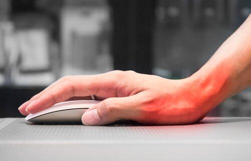 Carpal tunnel syndrom