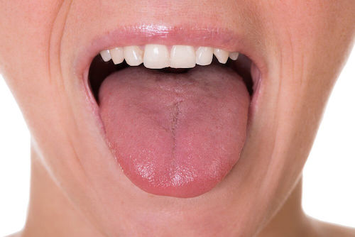 Person der raekker tunge - plak i halsen