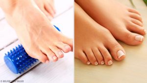 Kan man fjerne knyster uden at ty til operationer?