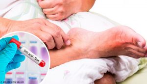 5 almindelige grunde til forhøjet urinsyreniveau