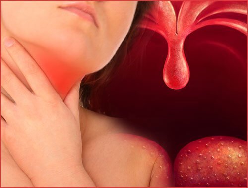 Betaendte mandler - plak i halsen