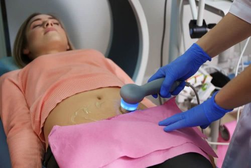 5 symptomer på polycystisk ovarie syndrom