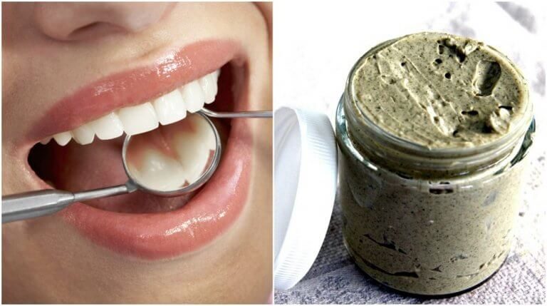 Sådan undgår du huller i tænderne