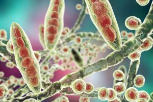 Sådan behandles fodsvamp derhjemme