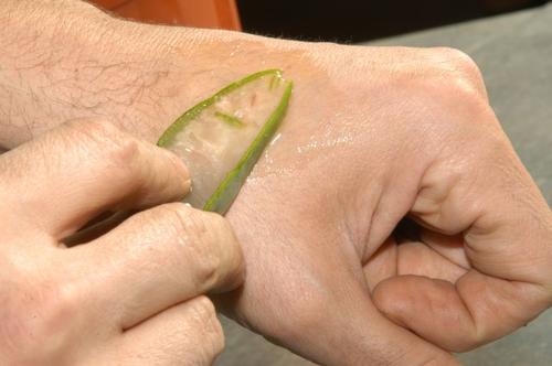 Aloe vera smørres på hånden