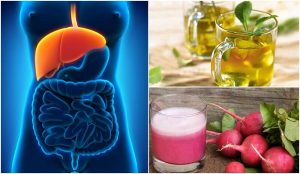 Opdag hvordan du kan behandle fedtlever naturligt