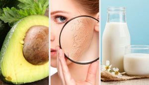 De 10 bedste hjemmelavede behandlinger mod tør hud