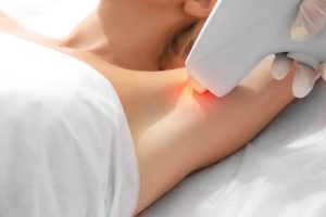 Myter og sandhed omkring hårfjerning med laser