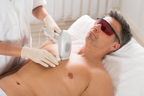 Man faar laserbehandling