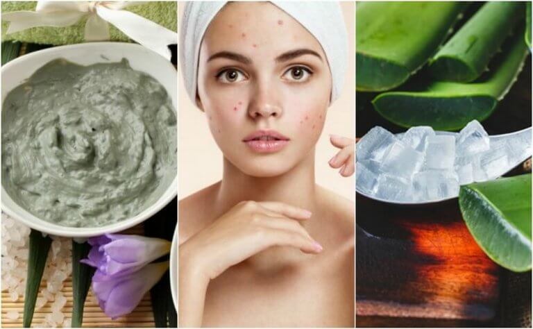 Smuk hud med naturlige midler.