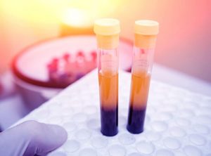 En aloe vera behandling til at øge antallet af blodplader