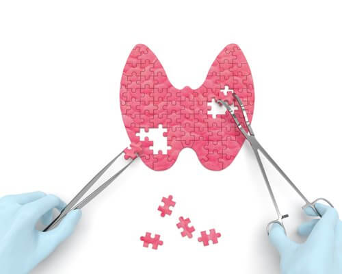 6 tegn på hypothyroidisme