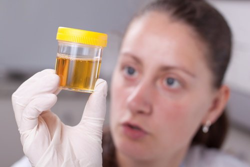 Kvinde med urinprøve
