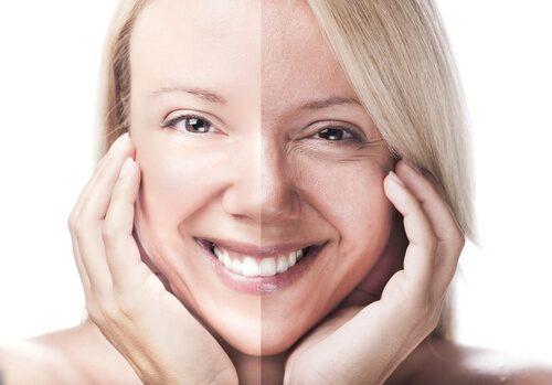 Kvinde med før og efter hud