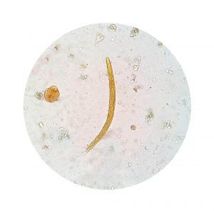 Prøv disse naturlige hjemmelavede kure mod Amøbiasis