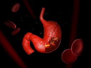 Urtemidler til at bekæmpe en Helicobacter Pylori infektion