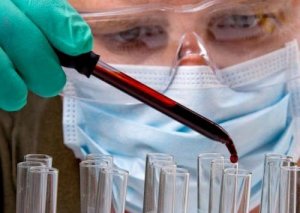 En simpel blodtest kan vise hvor din tumor er