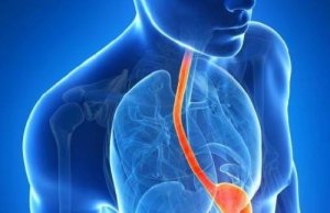 10 besynderlige symptomer på syre refluks