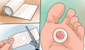 9 naturlige midler mod vabler