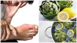 Sådan kan du eliminere urinsyre med artiskok og citronvand