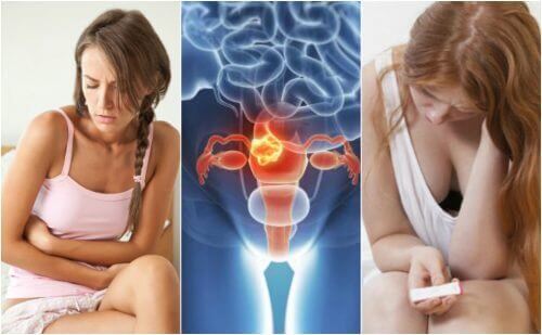 Fibroider i livmoderen?  5  vigtige fakta