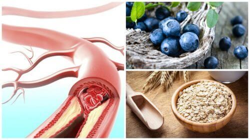 9 fødevarer til at forbedre dine arteriers sundhed