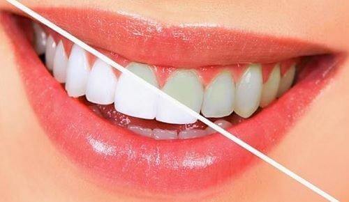 10 fødevarer, der kan blege dine tænder naturligt