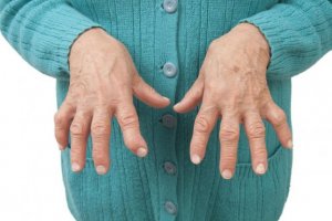 Smertelindrende midler mod reumatoid artritis