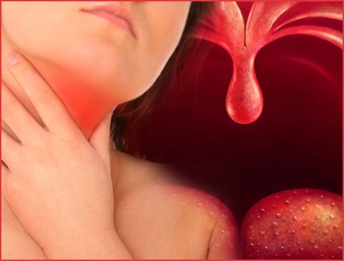 Lær at behandle halsbetændelse med disse hjemmemidler