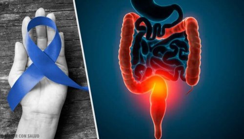 Ifølge WHO er der en sammenhæng mellem rødt kød og kræft