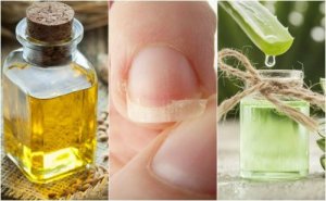 5 naturlige midler til at styrke svage negle