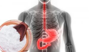 Prøv dette naturlige natronmiddel mod halsbrand