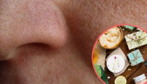 8 hjemmelavede midler til at mindske store porer