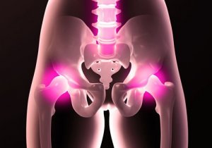 6 hjælpsomme råd til at forebygge smerter i hofterne