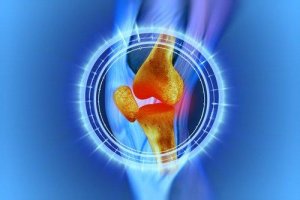 Knærehabilitering efter en meniskoperation