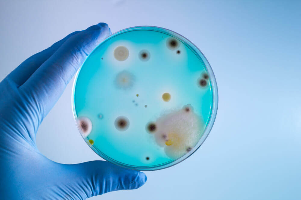 Pas på disse 9 farlige bakterier du bør undgå