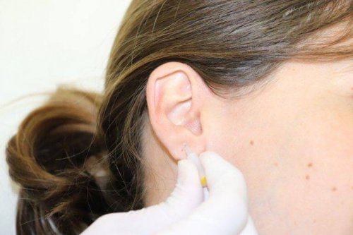 implantater sættes i ørets brusk
