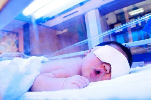 et spædbarn får behandling med lys
