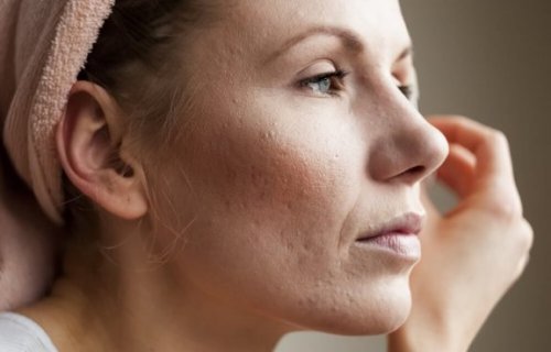 8 tips til at mindske porer