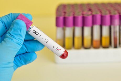 Blodprøve til tjek af smitsom kyssesyge