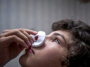 6 naturlige midler til at stoppe næseblod